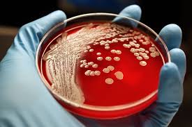Everything about Bacterial Infection