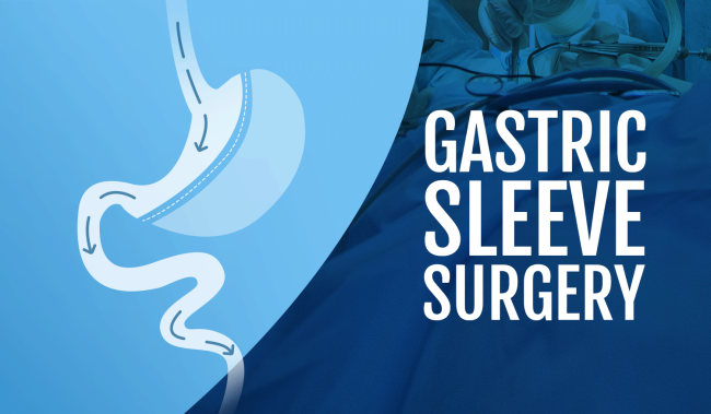 If You're Considering Weight Loss Gastric Sleeve Surgery, Here Are A Few Things To Consider