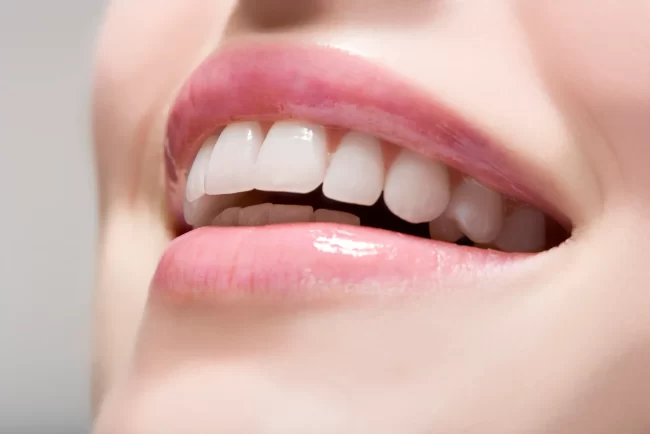 teeth whitening london ontario