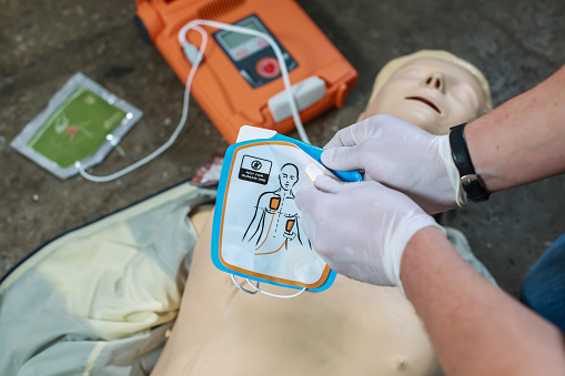 External Defibrillator Market
