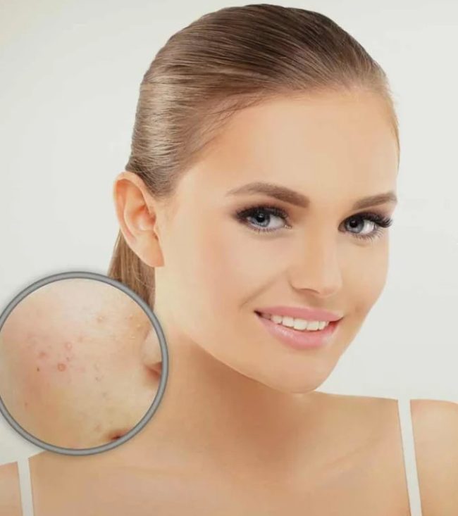 skin pigmentation laser skin clinic